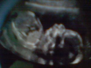 toi mon amour ;=)