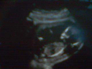 mon fils 
